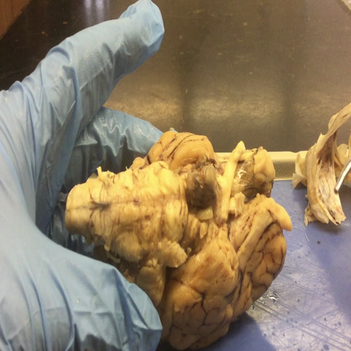 Sheep Brain External Anatomy