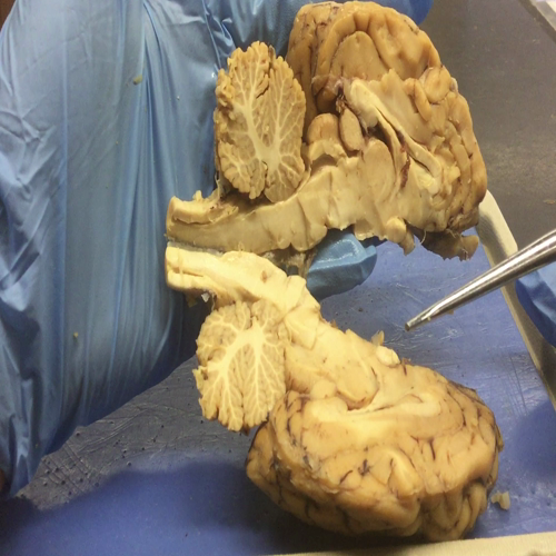 Sheep Brain Internal Anatomy